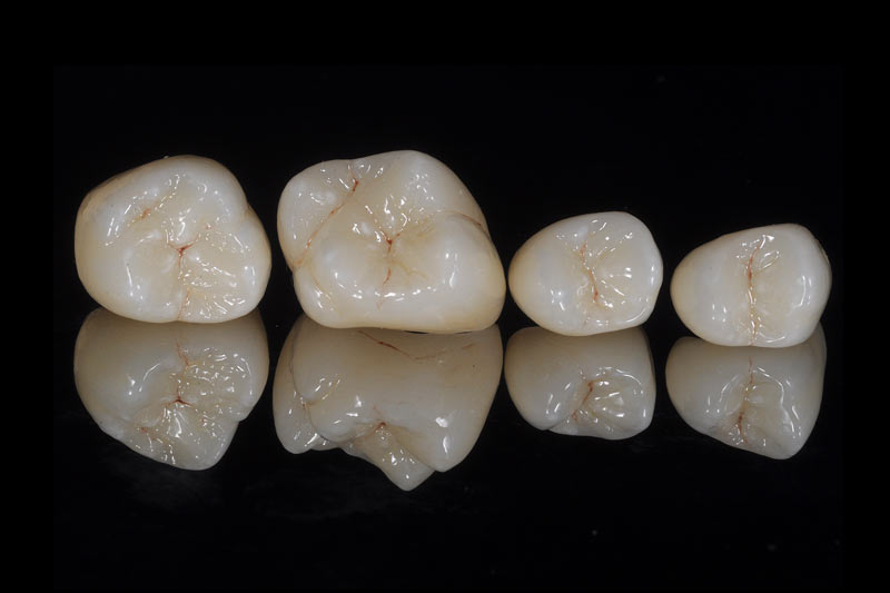 BJL平台集团|
这个卤蛋悦目又好吃 与牛肉面、卤肉饭是绝配 我家一周要做3次(图11) BJL平台集团